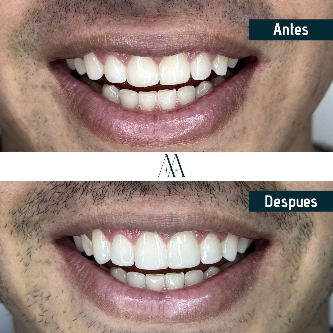 Ortodoncista en Cali