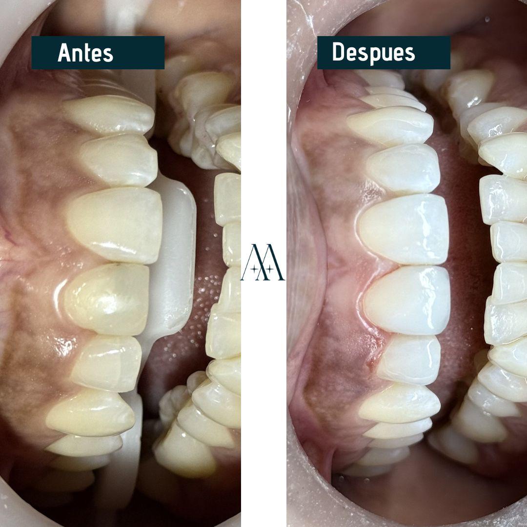 Prostodoncista en Cali