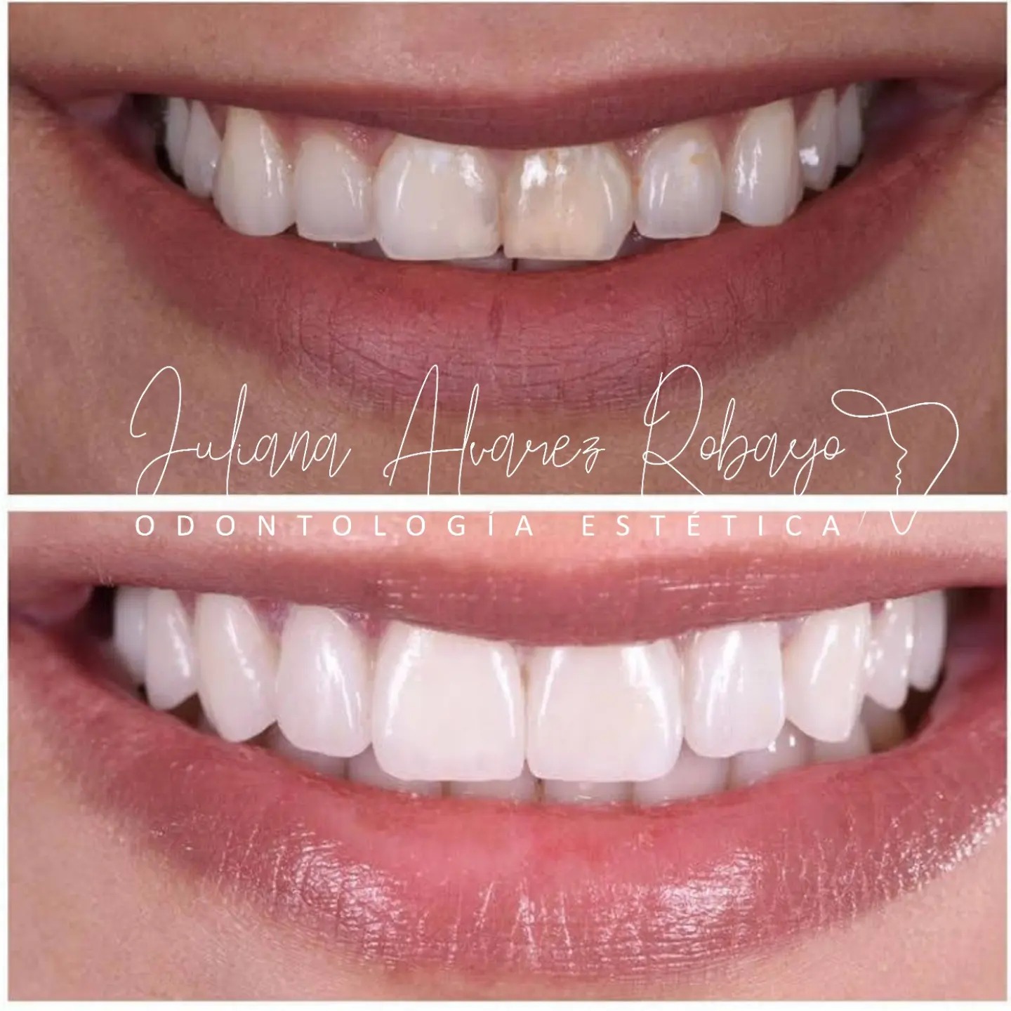 Higiene Oral Profunda